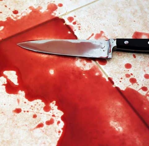סכין דם שש דקירות סכין בגופו של אנביה (צילום: אילוסטרציה)